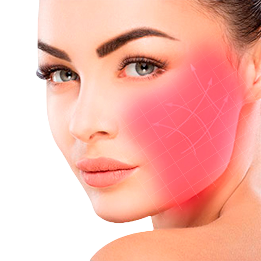 Facelift